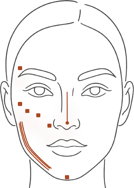 UP Contour, áreas de aplicação